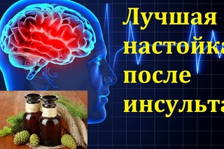 Лечение инсульта сосновыми шишками.Реабилитация после инсульта.