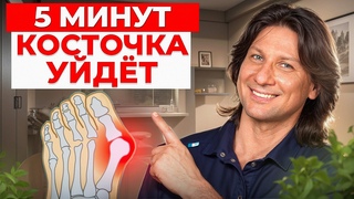 Шишка на большом пальце уйдет НАВСЕГДА! / Упражнения и рекомендации для устранения косточки