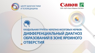 Каудальная группа черепно мозговых нервов: диф. диагноз образований в зоне яремного отверстия