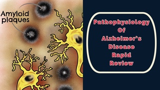 Alzheimer’s Disease Pathophysiology Rapid Review
