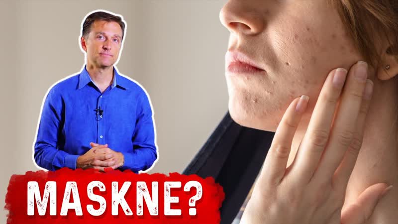 Acne Caused from the Mask: