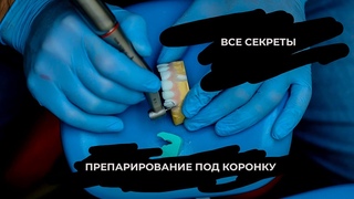 ПРЕПАРИРОВАНИЕ ПОД КОРОНКУ(все секреты препа)