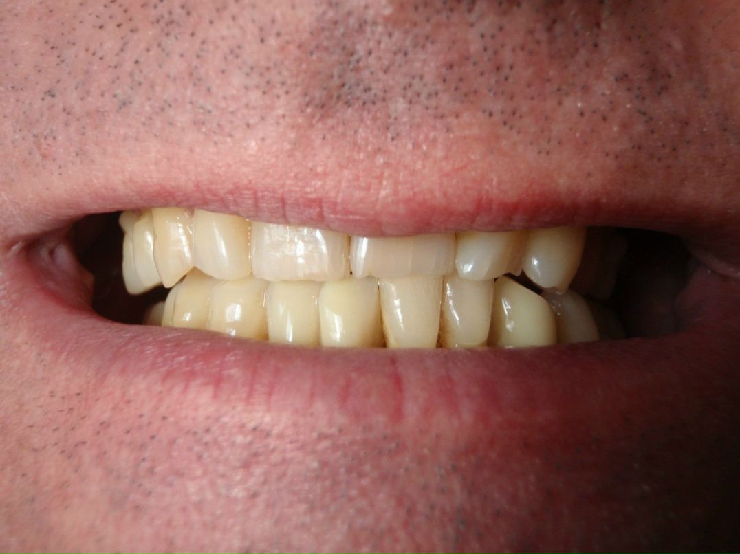 Эрнест Абрамян | Москва