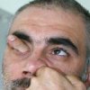 Аватар: Адольф Ашотович