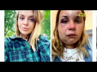 На редактора телеканалу Інтер сконо жорстокий напад у купе потягу Маріуполь-Київ