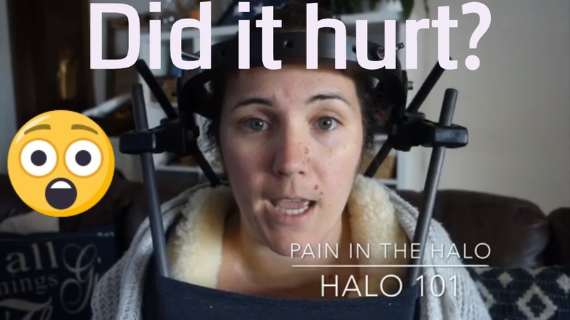 Surgical Halo Installation Pain in the Halo Living in a Surgical Halo