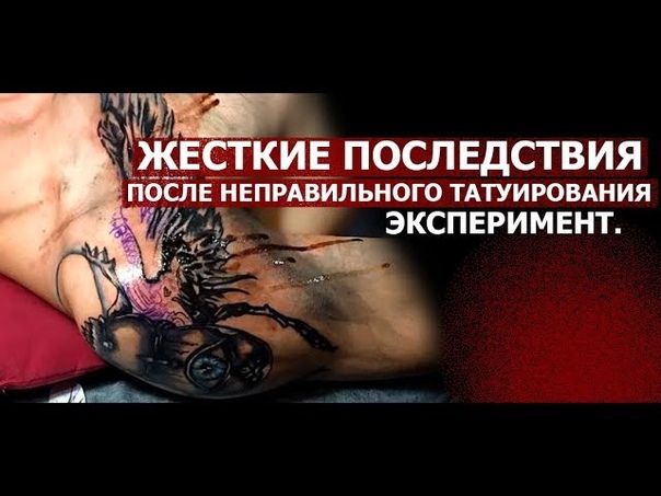 ЖЕСТКИЕ ПОСЛЕДСТВИЯ ПОСЛЕ НЕПРАВИЛЬНОГО ТАТУИРОВАНИЯ.